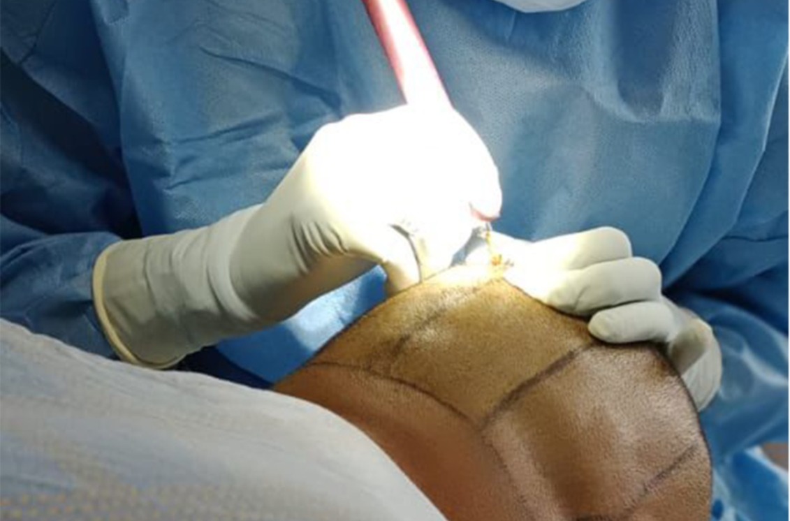 Regenerative medicine; Africa’s next great medical frontier Regenerative medicine; Africa's next great medical frontier