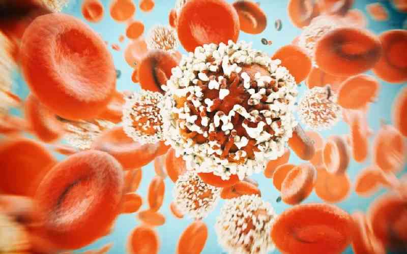 Why are more under-50s getting colorectal cancer? 'We don't know' Why are more under-50s getting colorectal cancer? 'We don't know'