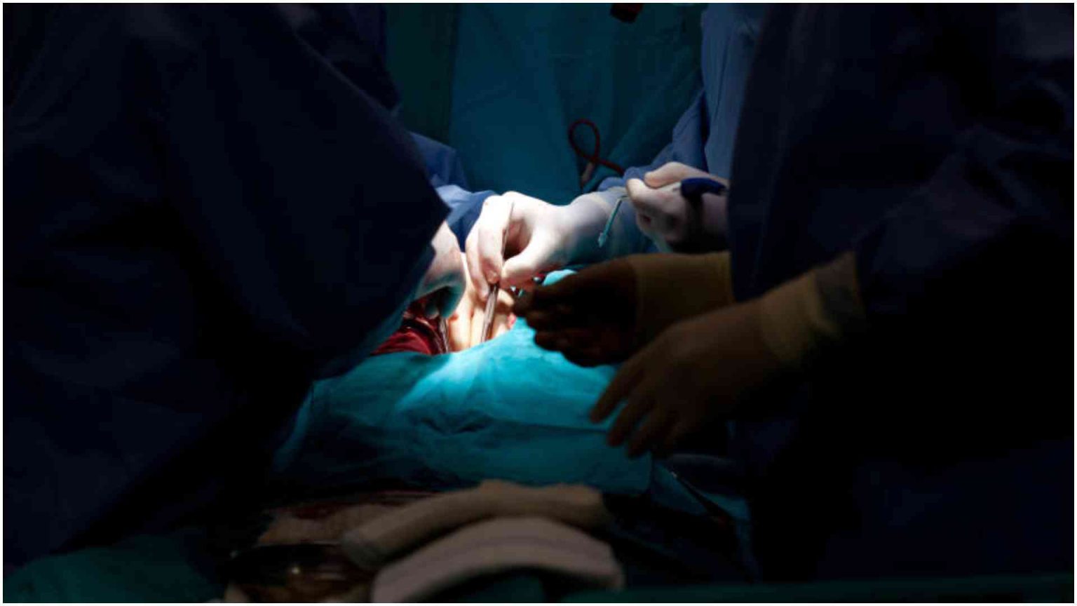 Woman dies after ‘drunk quack’ allegedly performs surgery using YouTube tutorial Woman dies after 'drunk quack' allegedly performs surgery using YouTube tutorial